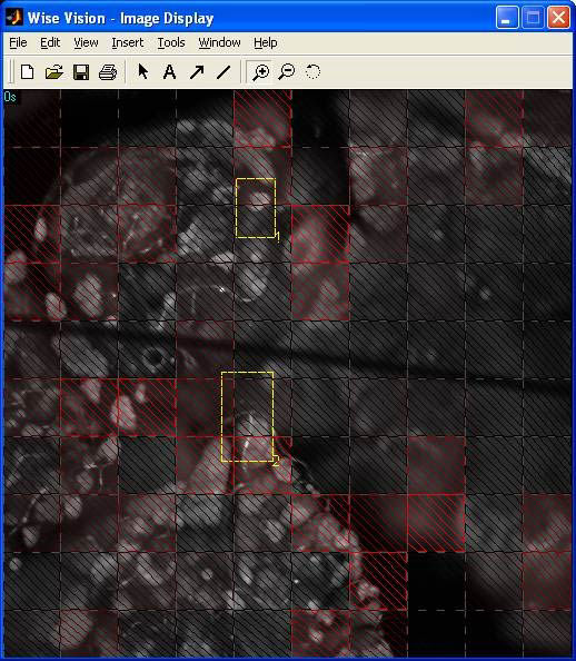 Programm zur Analyse mikroskopischer Bilder